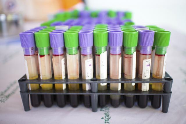 Da li je besnilo u Srbiji otišlo u istoriju?